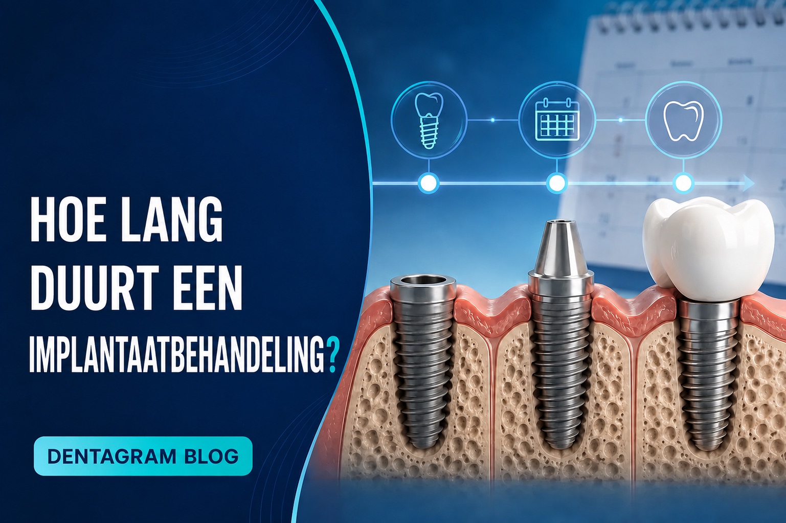 Tijdlijn van een tandimplantaatbehandeling