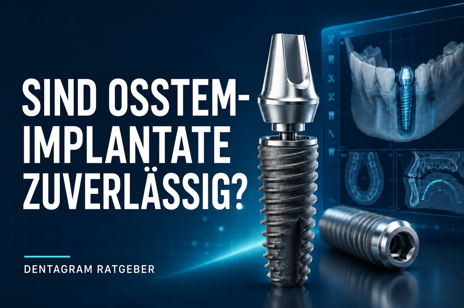 Sind Osstem-Implantate zuverlässig? Osstem-Implantate – Zuverlässigkeit und digitale Behandlungsplanung