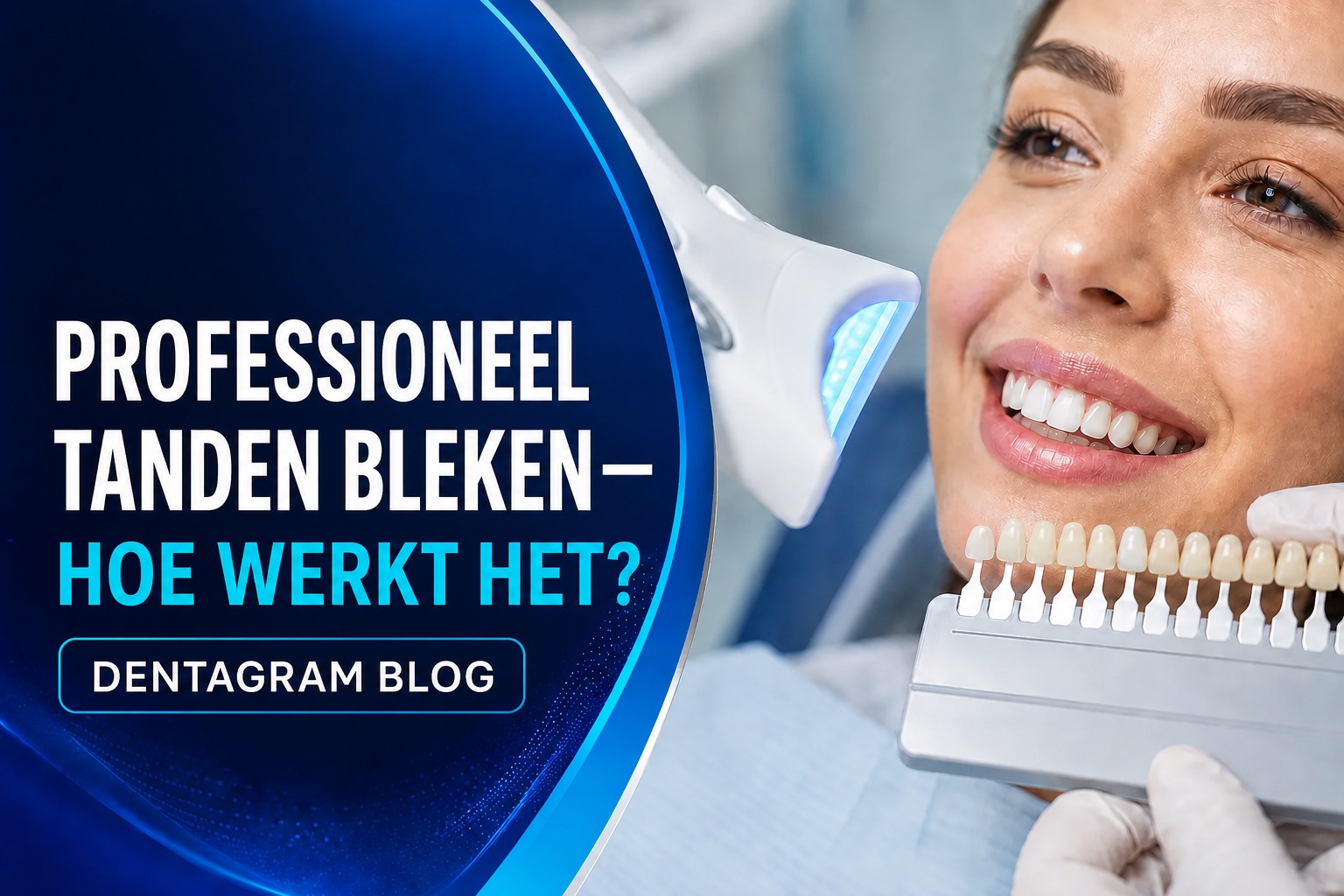 Professioneel tanden bleken Professioneel tanden bleken met kleurgids