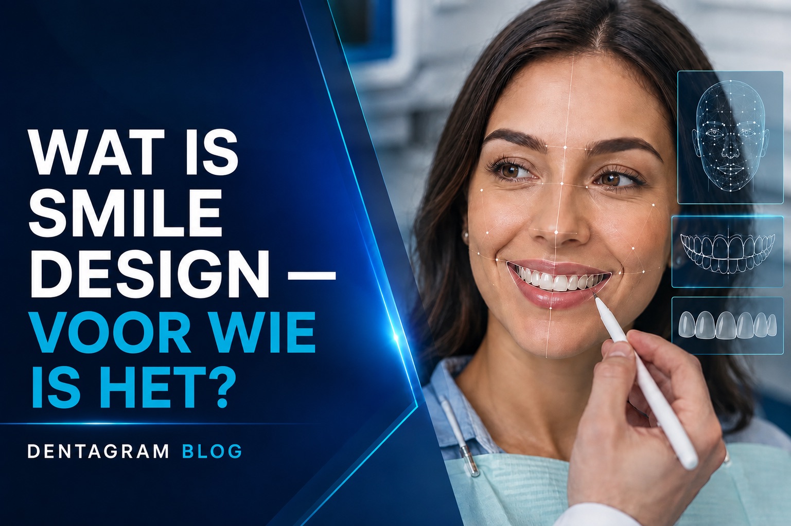 Wat is smile design? Digitale analyse voor een natuurlijk ogend smile design