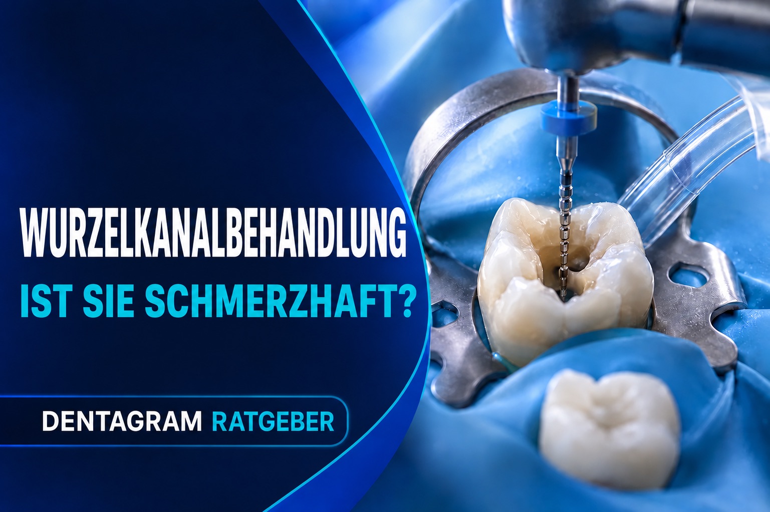 Wurzelkanalbehandlung unter Kofferdam